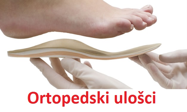 Ortopedski ulošci za stopala - upotreba, iskustva i cena