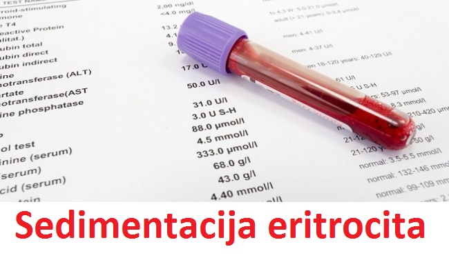 Sedimentacija eritrocita - referentne vrednosti i sve što treba da znate