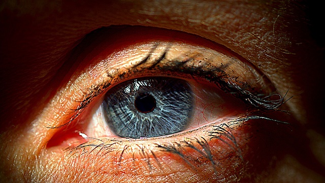 Visok očni pritisak – simptomi, uzrok, normalne vrednosti i lečenje